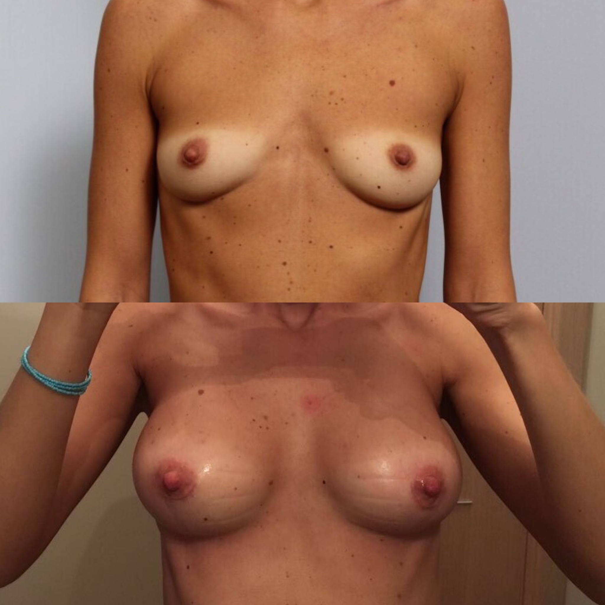 форум женщин с кистой груди фото 55